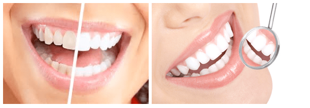 Dazzling White Instant Teeth Whitening Pen